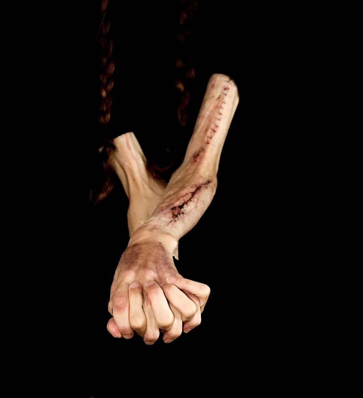 arms, hands, scars, self harm, human, depression, scars, self harm, self harm, self harm, self harm, self harm
